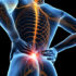Piriformis Syndrome, Buttock Pain, Physical Therapy