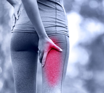 Right hamstring pain caused by scroiliac joint dysfunction