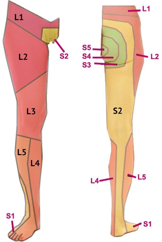 Referral patterns of the Sacroiliac joint, facet joints, and myofascial system.