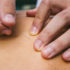 Learn the differences between acupuncture and dry needling